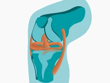 Артроскопия